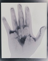 After Ethyl 1993