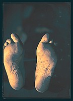 Feet 1908 / 2008